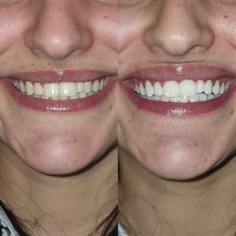 Teeth 5