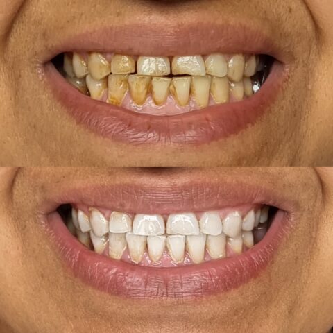 Teeth 6
